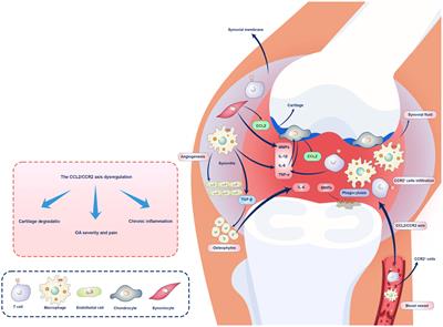 Harmonizing hope: navigating the osteoarthritis melody through the CCL2/CCR2 axis for innovative therapeutic avenues